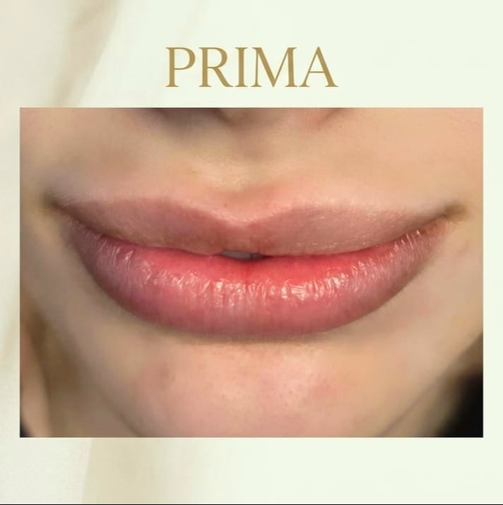 Trucco Semi-Permanente Labbra - prima